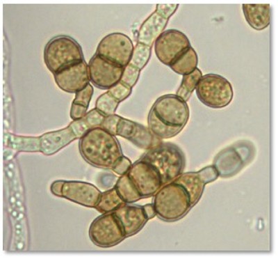 Les chercheurs étudient les spores du champignon phytopathogène Alternaria brassicicola.